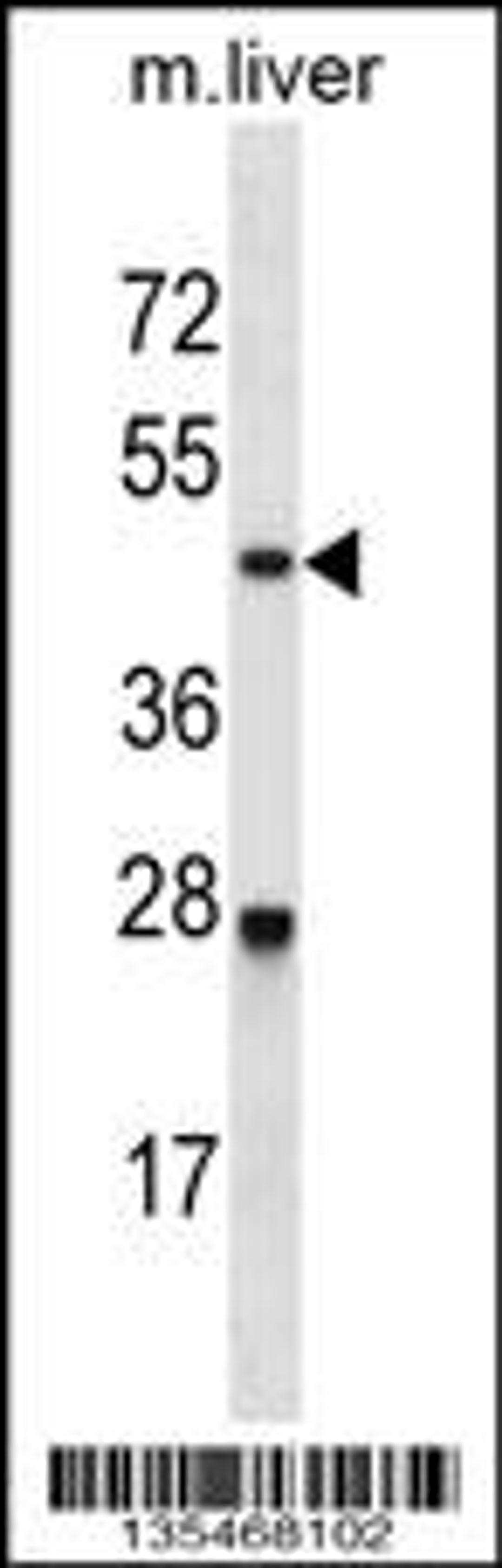 Western blot analysis in mouse liver tissue lysates (35ug/lane).