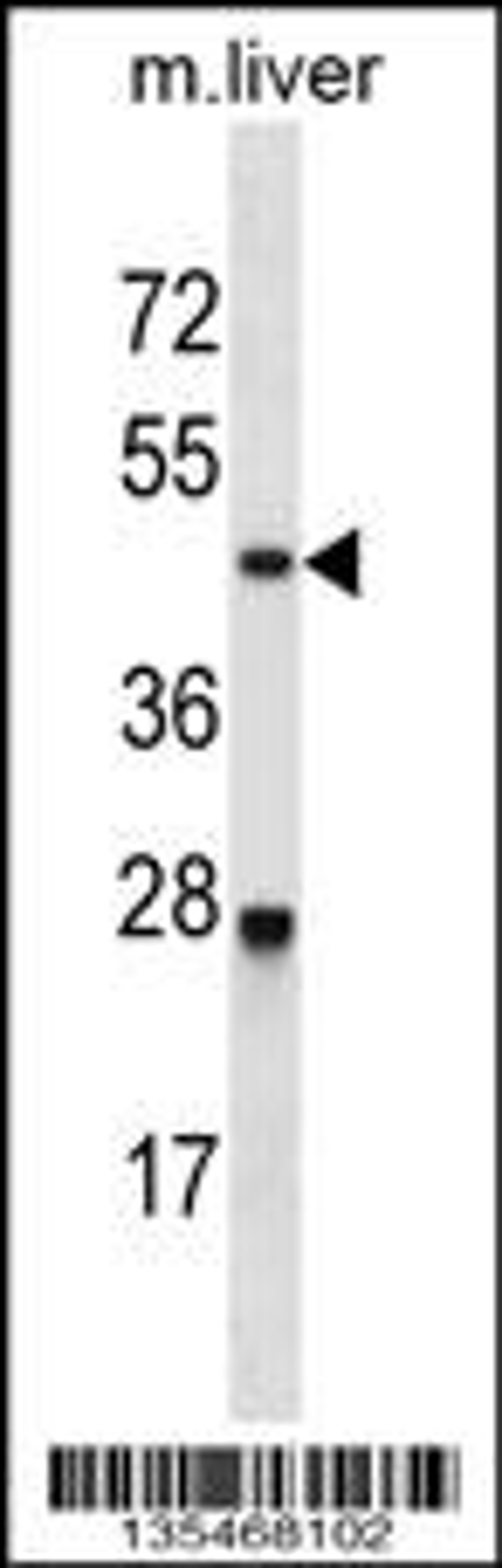 Western blot analysis in mouse liver tissue lysates (35ug/lane).