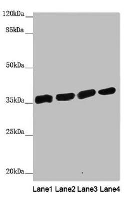Western blot. All lanes: ANKRD1 antibody at 1.91µg/ml. Lane 1: Hela whole cell lysate. Lane 2: 293T whole cell lysate. Lane 3: Jurkat whole cell lysate. Lane 4: HepG2 whole cell lysate. Secondary. Goat polyclonal to rabbit IgG at 1/10000 dilution. Predicted band size: 36 kDa. Observed band size: 36 kDa
