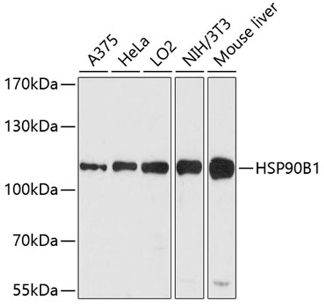 Western blot - HSP90B1 antibody (A0989)