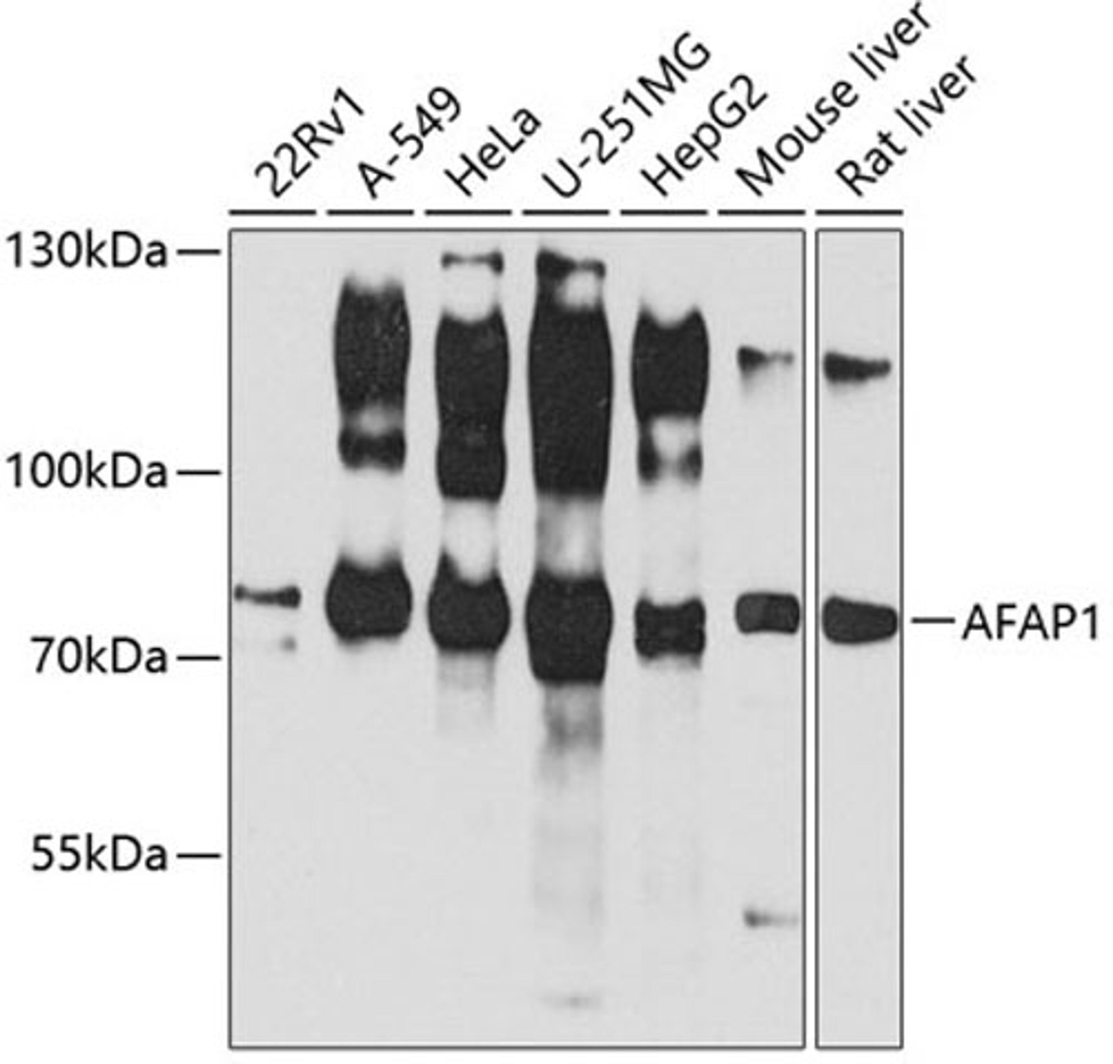 Western blot - AFAP1 antibody (A3478)