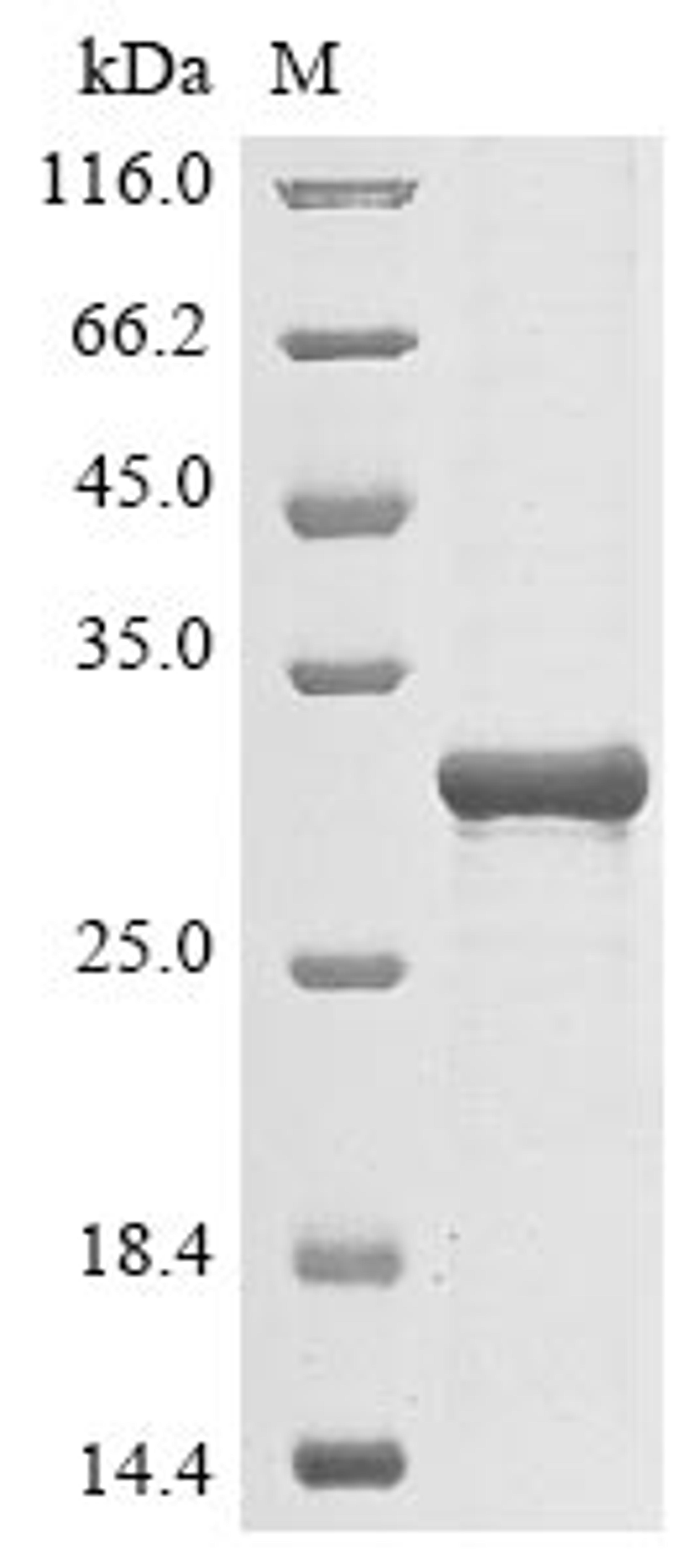 (Tris-Glycine gel) Discontinuous SDS-PAGE (reduced) with 5% enrichment gel and 15% separation gel.