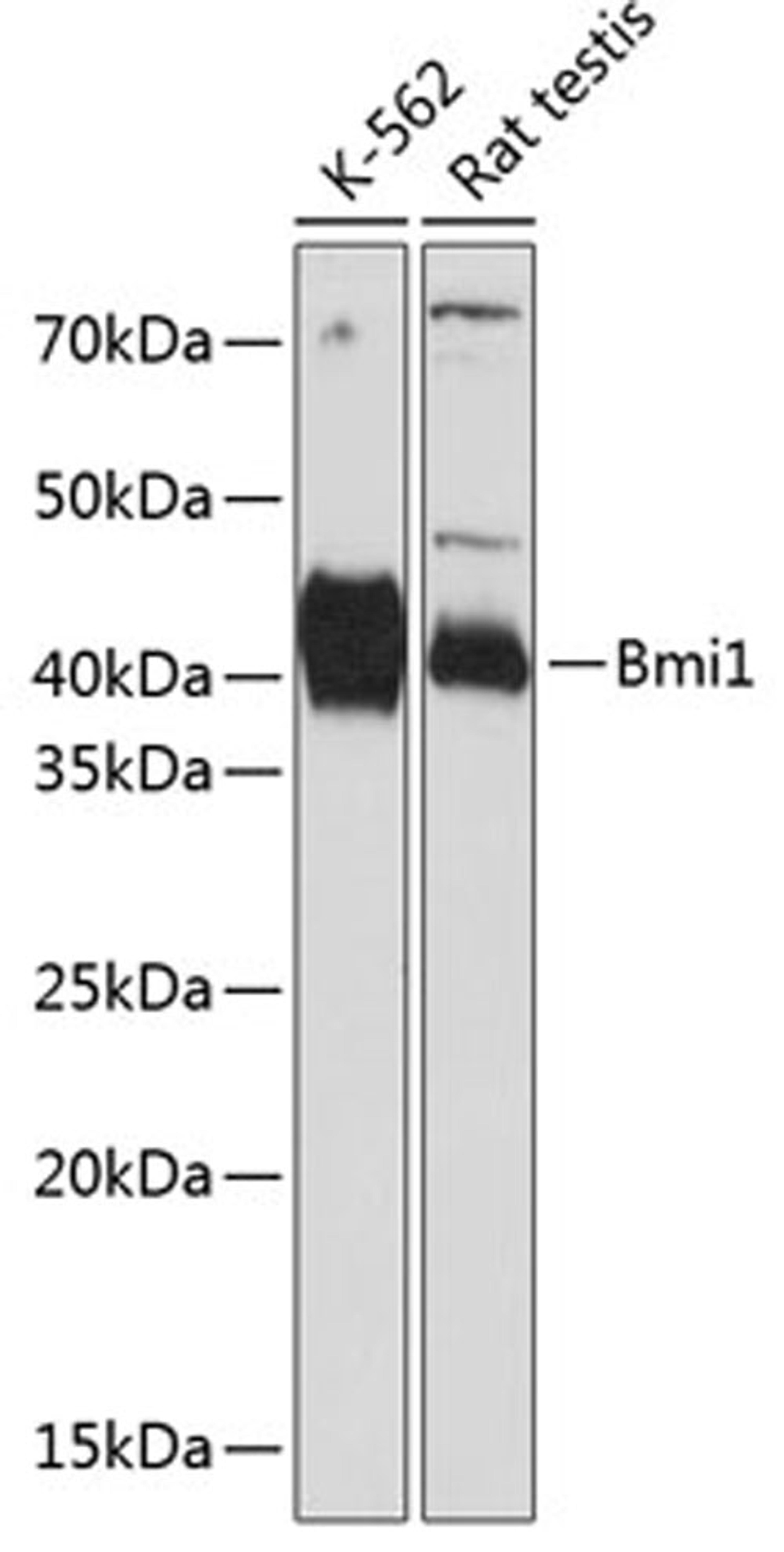 Western blot - Bmi1 antibody (A17914)