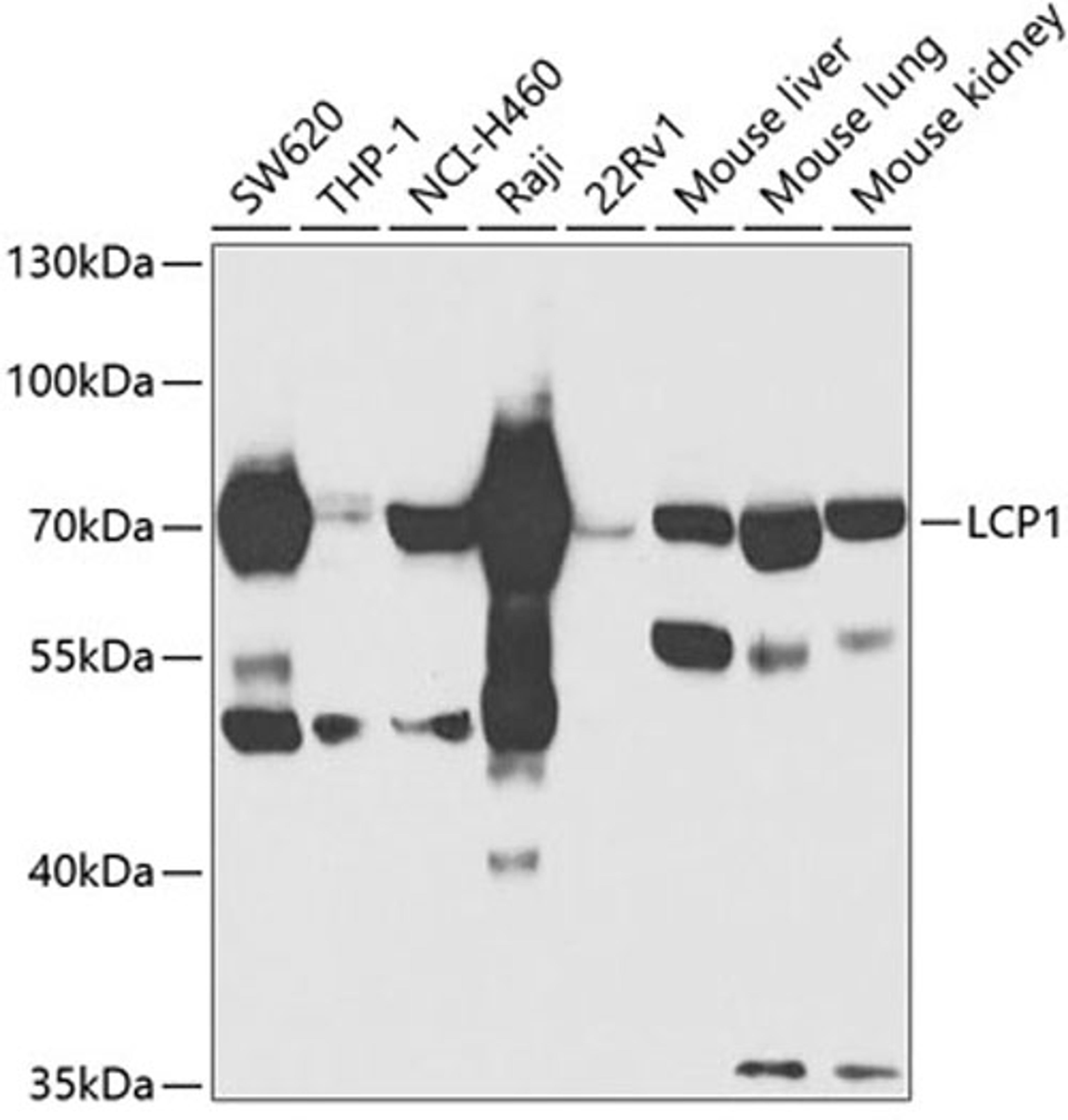 Western blot - LCP1 antibody (A13504)