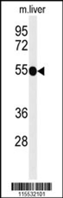 Western blot analysis of TNFRSF8-Y479 in mouse liver tissue lysates (35ug/lane)