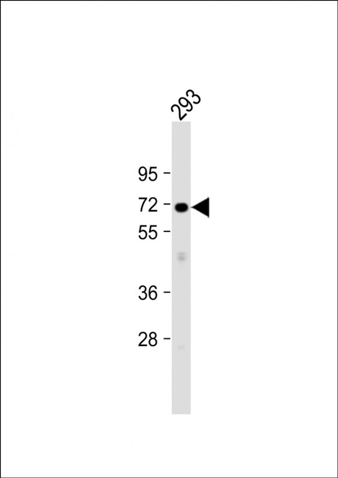 Western Blot at 1:1000 dilution + 293 whole cell lysate Lysates/proteins at 20 ug per lane.