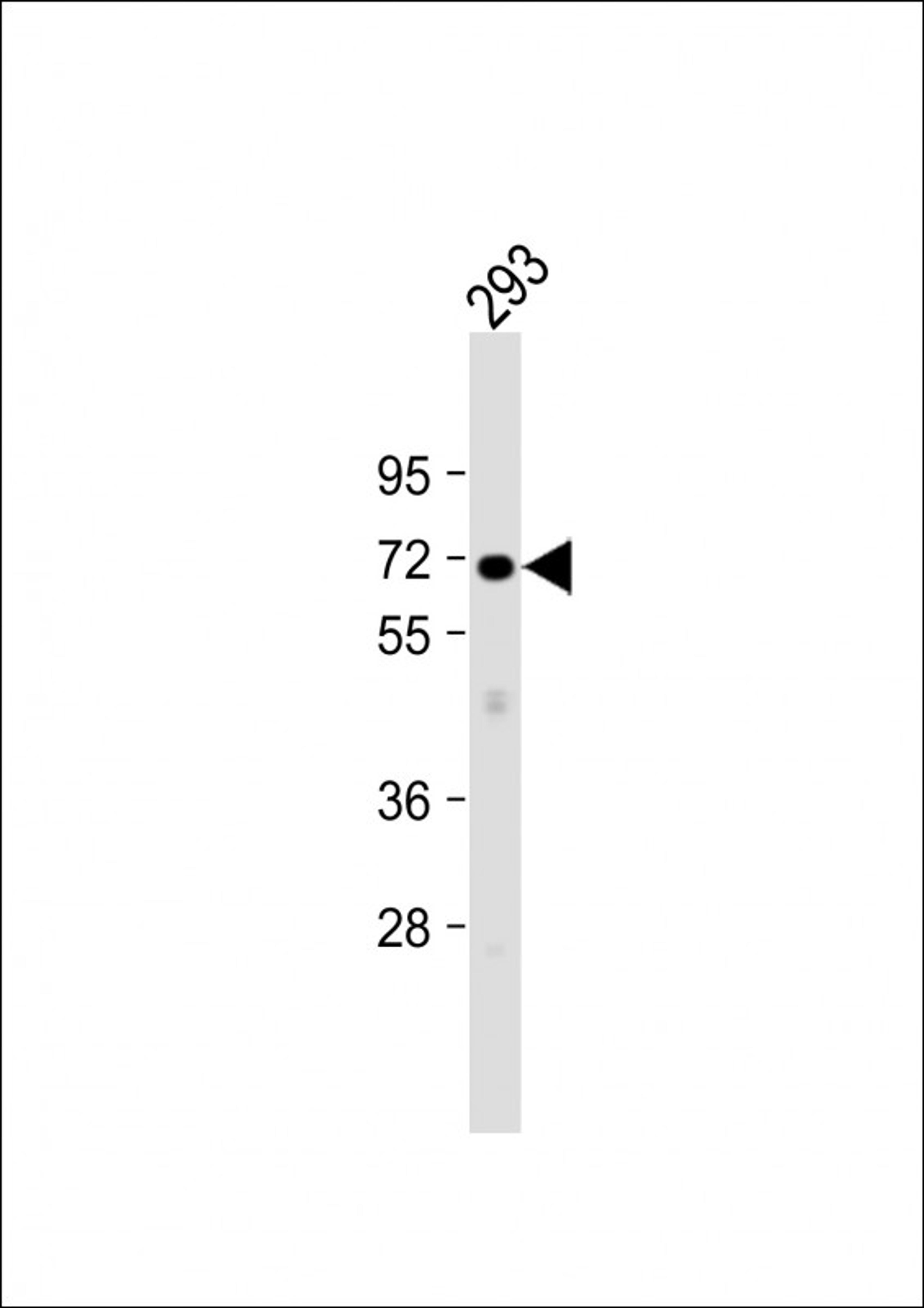 Western Blot at 1:1000 dilution + 293 whole cell lysate Lysates/proteins at 20 ug per lane.