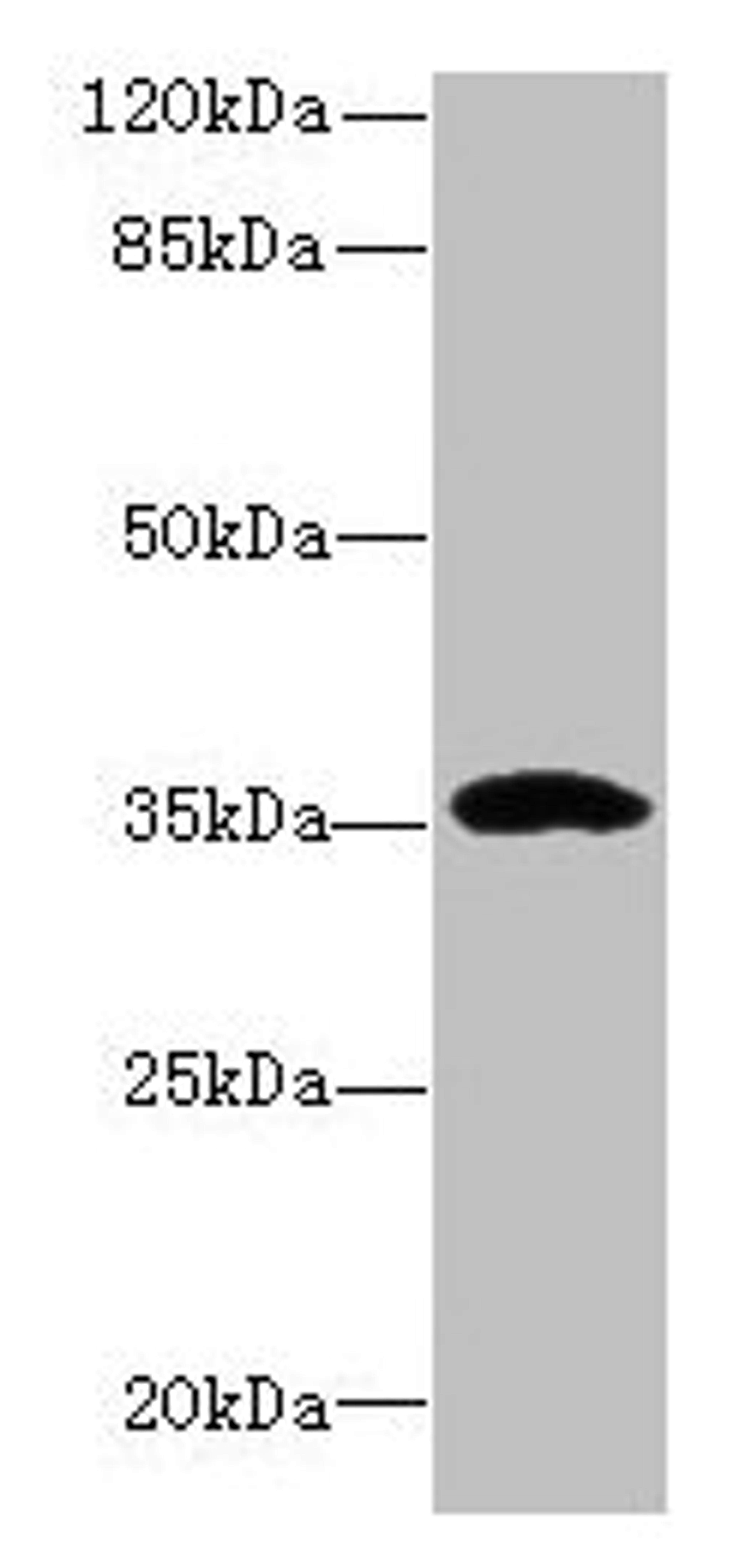 Western blot. All lanes: CCDC24 antibody at 6µg/ml + MCF-7 whole cell lysate. Secondary. Goat polyclonal to rabbit IgG at 1/10000 dilution. Predicted band size: 35, 31 kDa. Observed band size: 35 kDa
