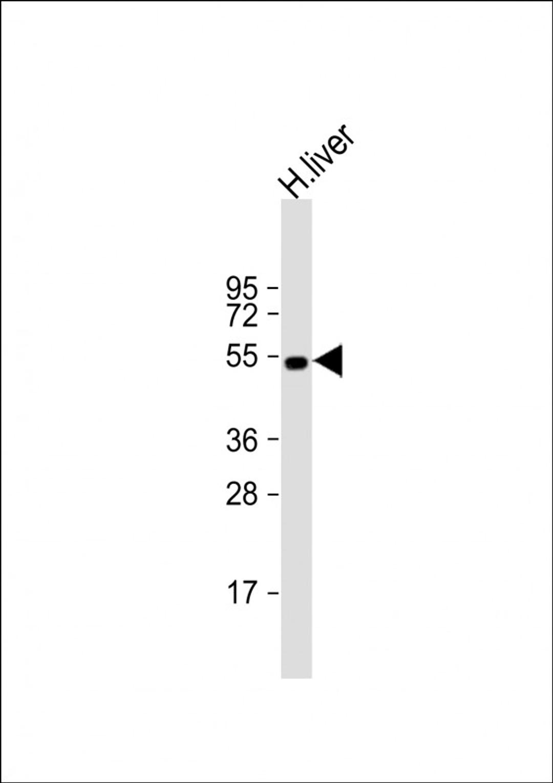 Western Blot at 1:1000 dilution + human liver lysate Lysates/proteins at 20 ug per lane.