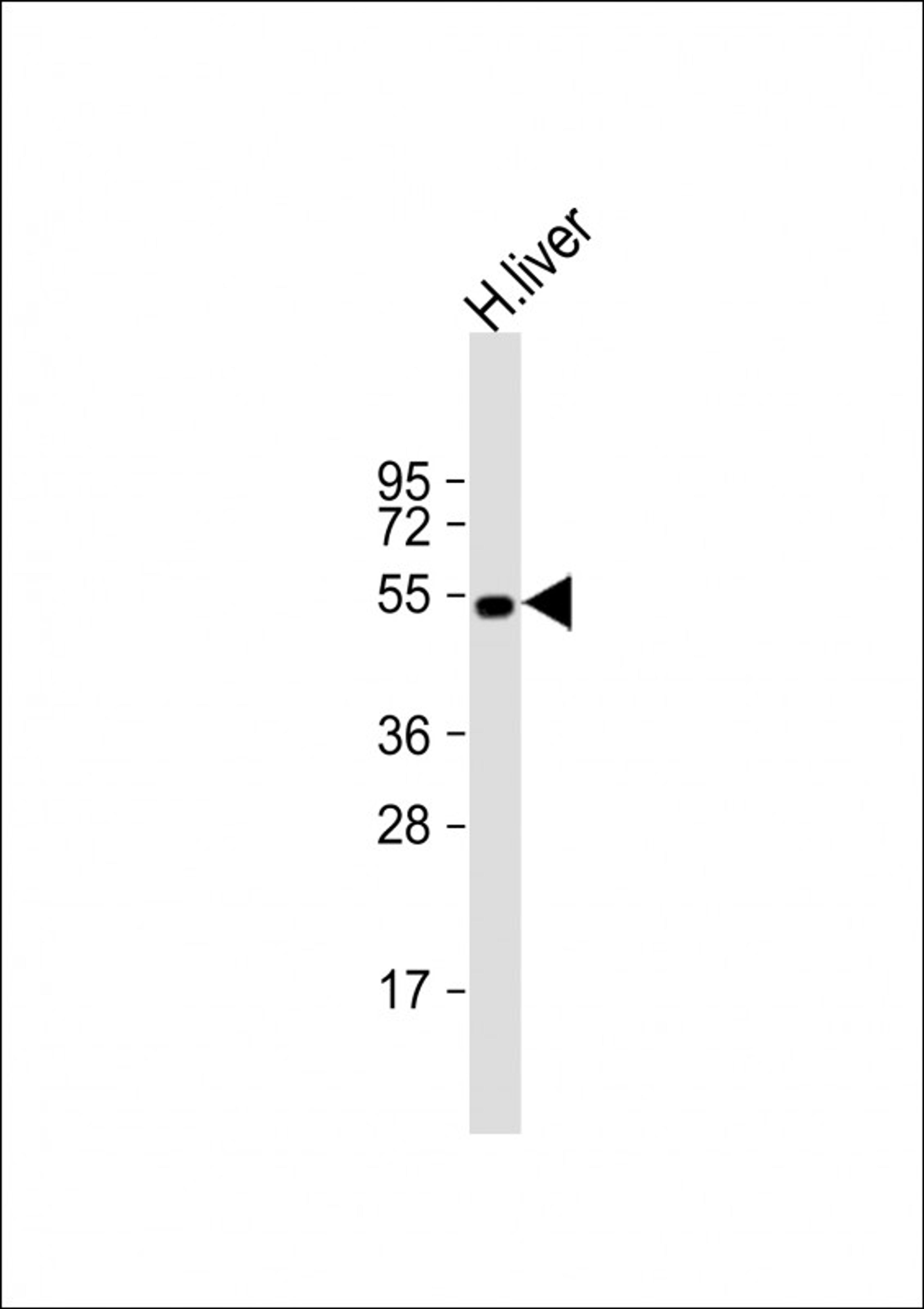 Western Blot at 1:1000 dilution + human liver lysate Lysates/proteins at 20 ug per lane.