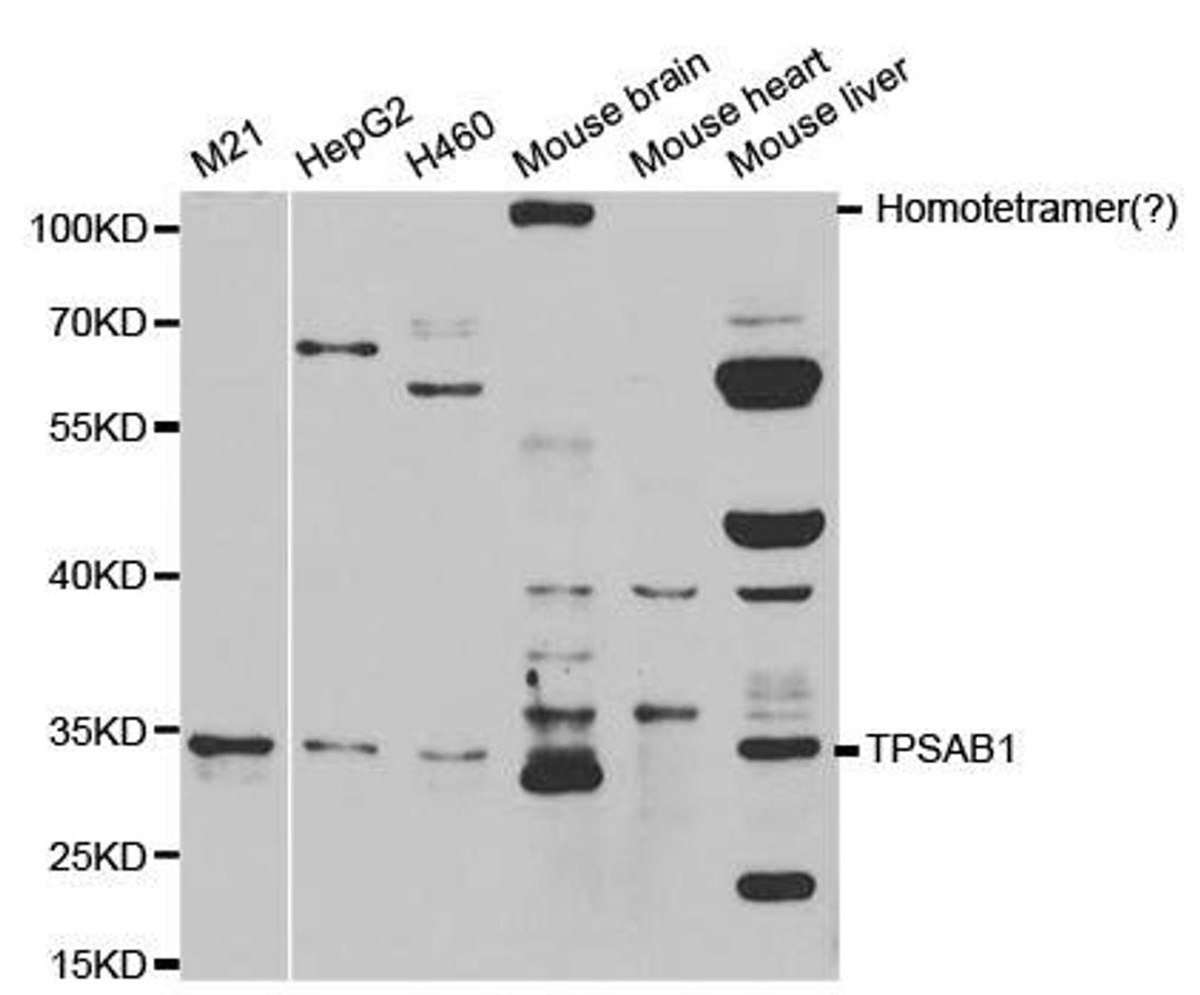 Western blot analysis of extracts of various cell lines using TPSAB1 antibody