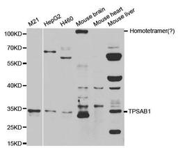 Western blot analysis of extracts of various cell lines using TPSAB1 antibody