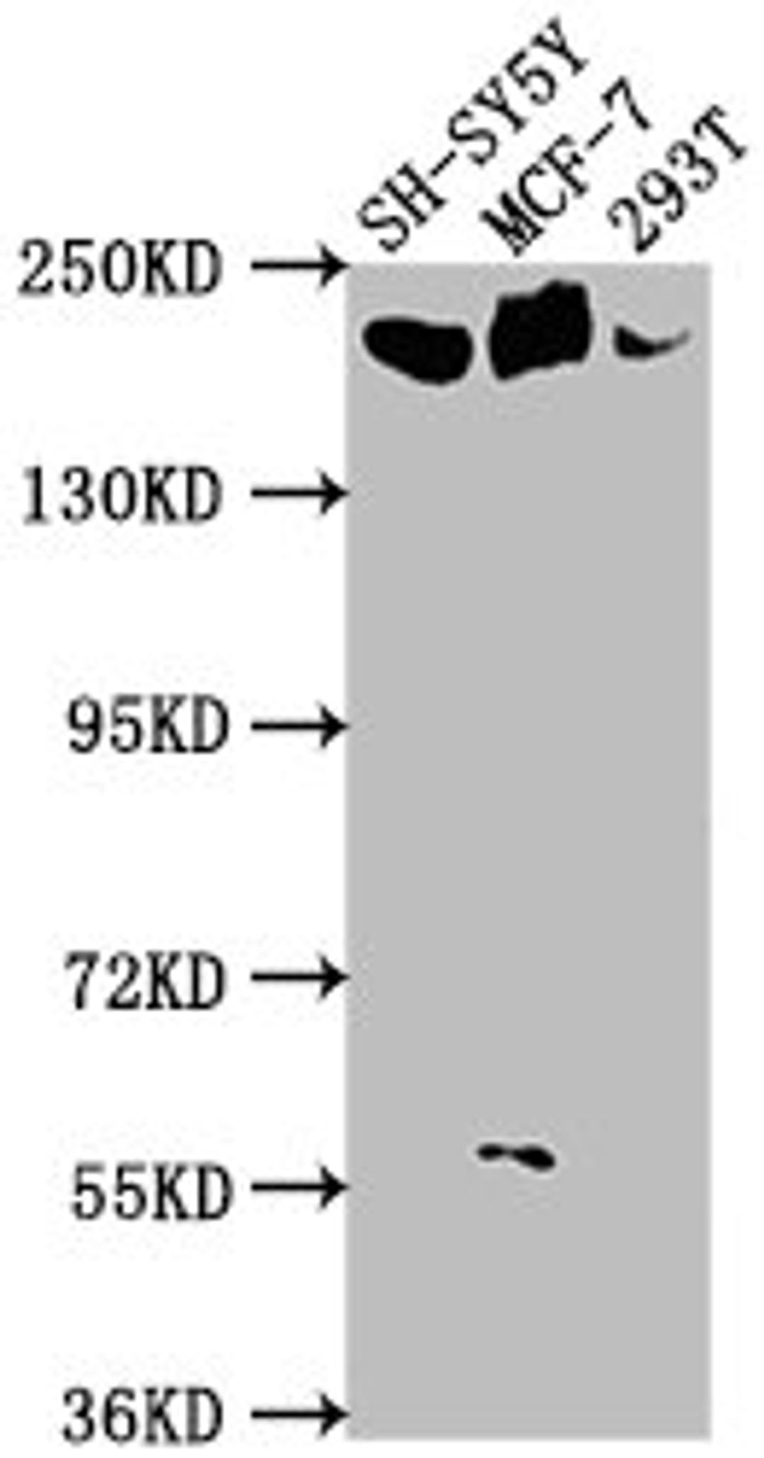 Western Blot. Positive WB detected in: SH-SY5Y whole cell lysate, MCF-7 whole cell lysate, 293T whole cell lysate. All lanes: LAMA4 antibody at 1:1000. Secondary. Goat polyclonal to rabbit IgG at 1/50000 dilution. Predicted band size: 203, 202, 13 kDa. Observed band size: 203 kDa.