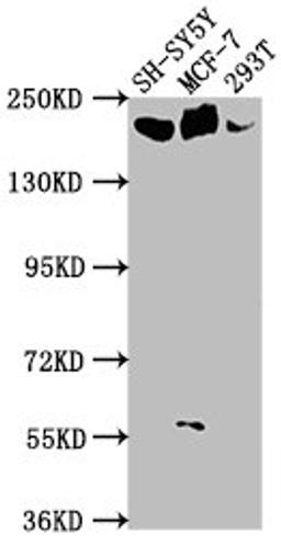 Western Blot. Positive WB detected in: SH-SY5Y whole cell lysate, MCF-7 whole cell lysate, 293T whole cell lysate. All lanes: LAMA4 antibody at 1:1000. Secondary. Goat polyclonal to rabbit IgG at 1/50000 dilution. Predicted band size: 203, 202, 13 kDa. Observed band size: 203 kDa.