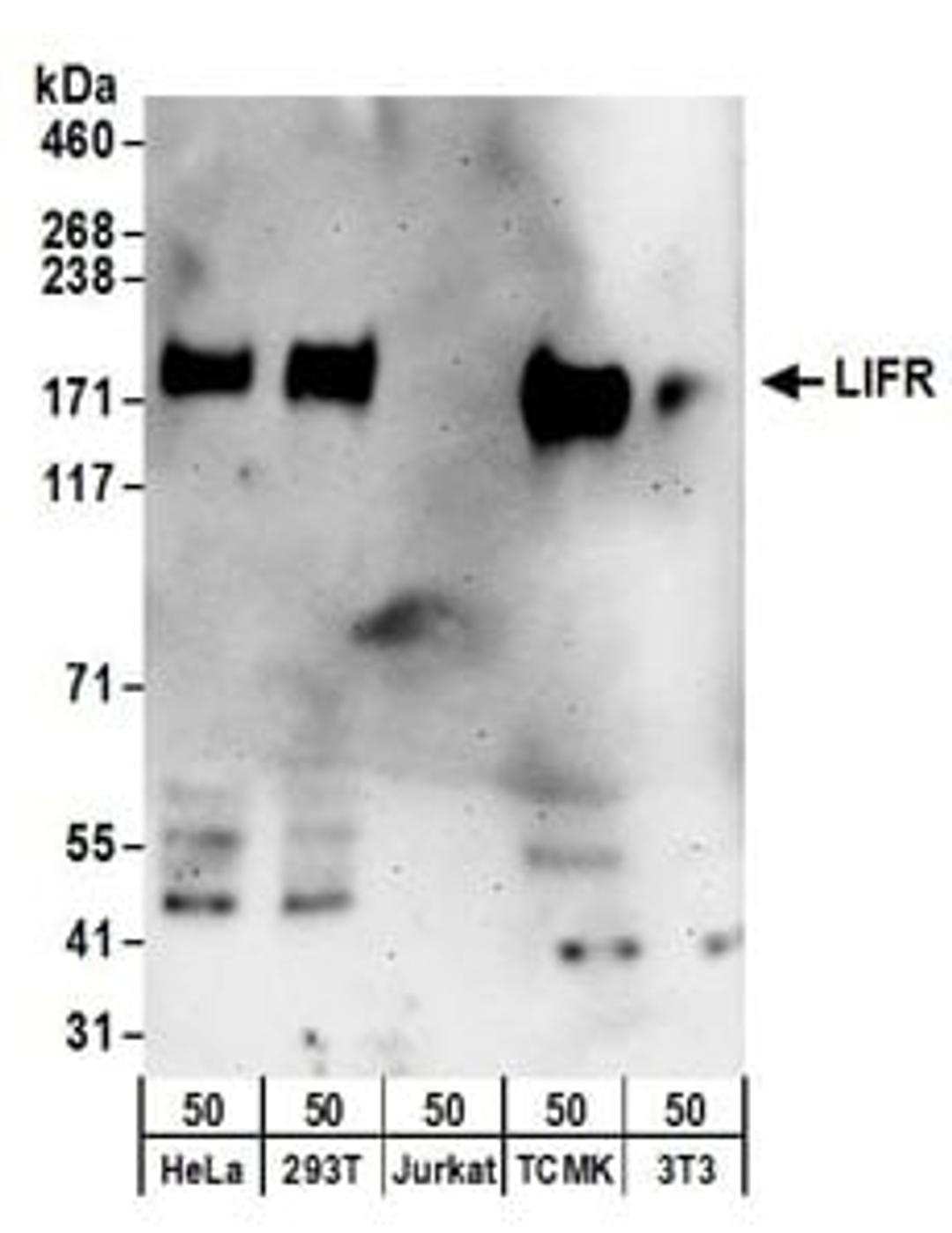 Detection of human and mouse LIFR by western blot.