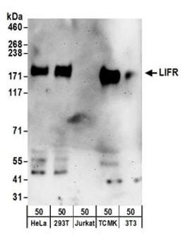 Detection of human and mouse LIFR by western blot.