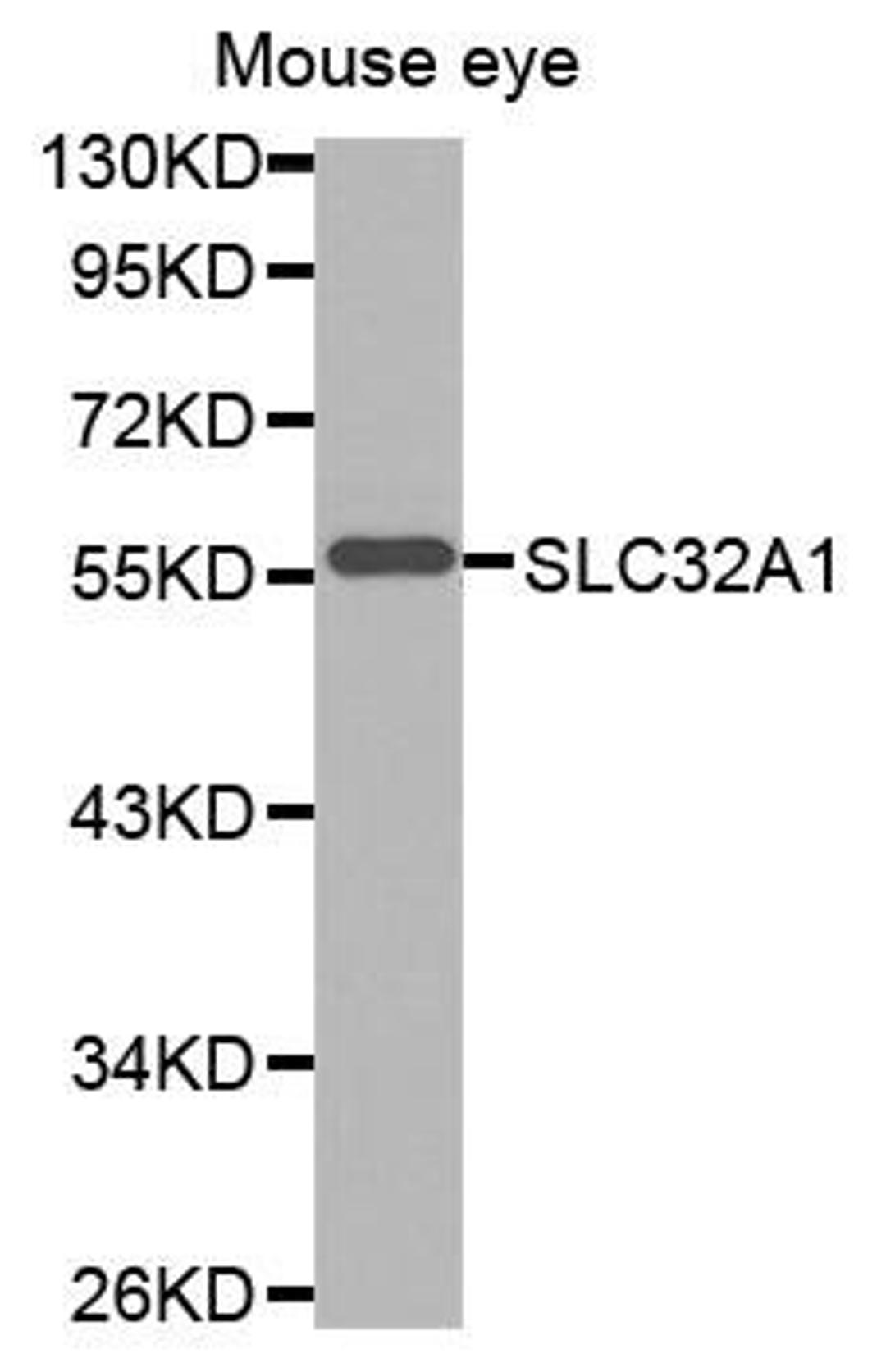 Western blot analysis of extracts of mouse eye tissue lysate using SLC32A1 antibody