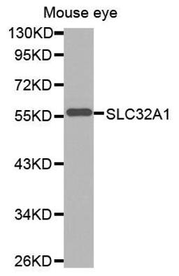 Western blot analysis of extracts of mouse eye tissue lysate using SLC32A1 antibody