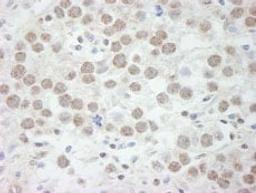 Detection of human DDX17 by immunohistochemistry.