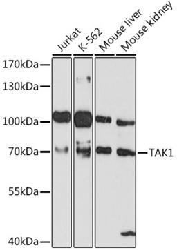 Western blot - TAK1 antibody (A12022)