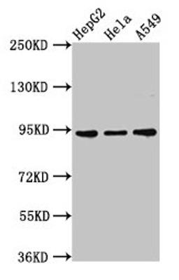 Western Blot. Positive WB detected in: HepG2 whole cell lysate, Hela whole cell lysate, A549 whole cell lysate. All lanes: CHD1L antibody at 3µg/ml. Secondary. Goat polyclonal to rabbit IgG at 1/50000 dilution. Predicted band size: 101, 91, 78, 89, 70 kDa. Observed band size: 91 kDa