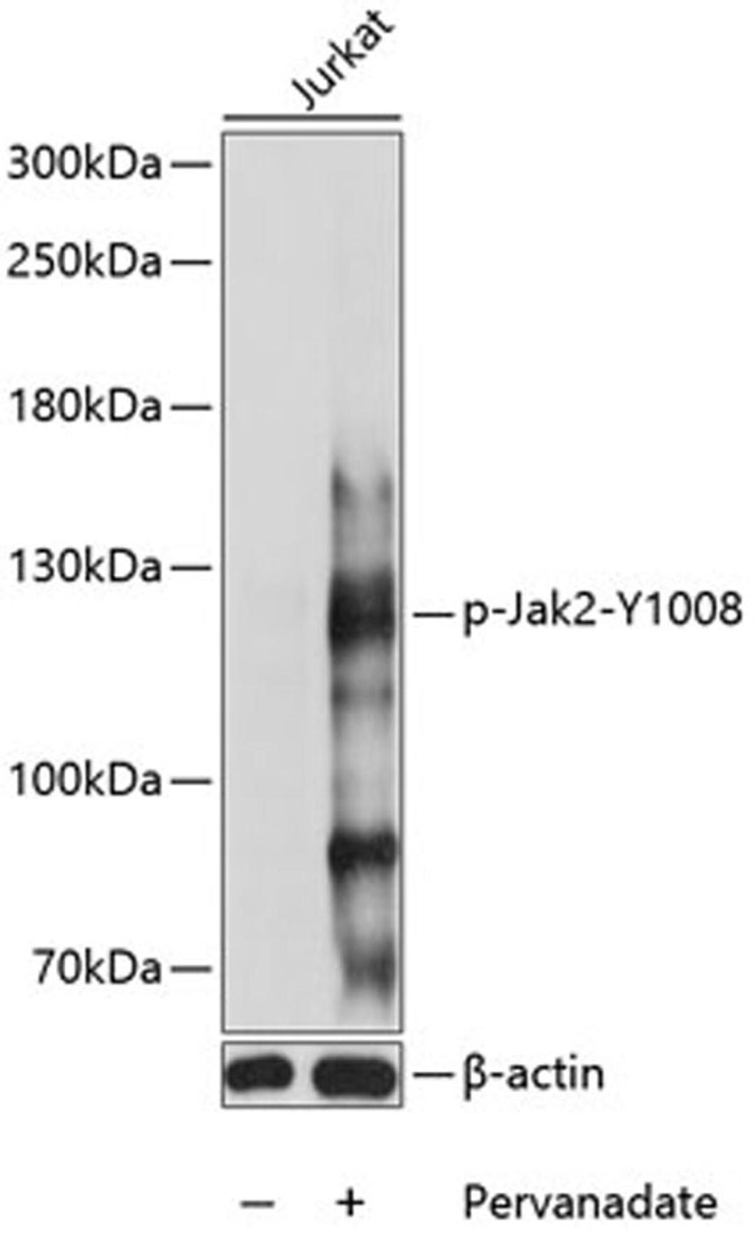 Western blot - Phospho-Jak2-Y1008 antibody (AP0772)