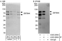 Detection of human ZBTB44 by western blot and immunoprecipitation.