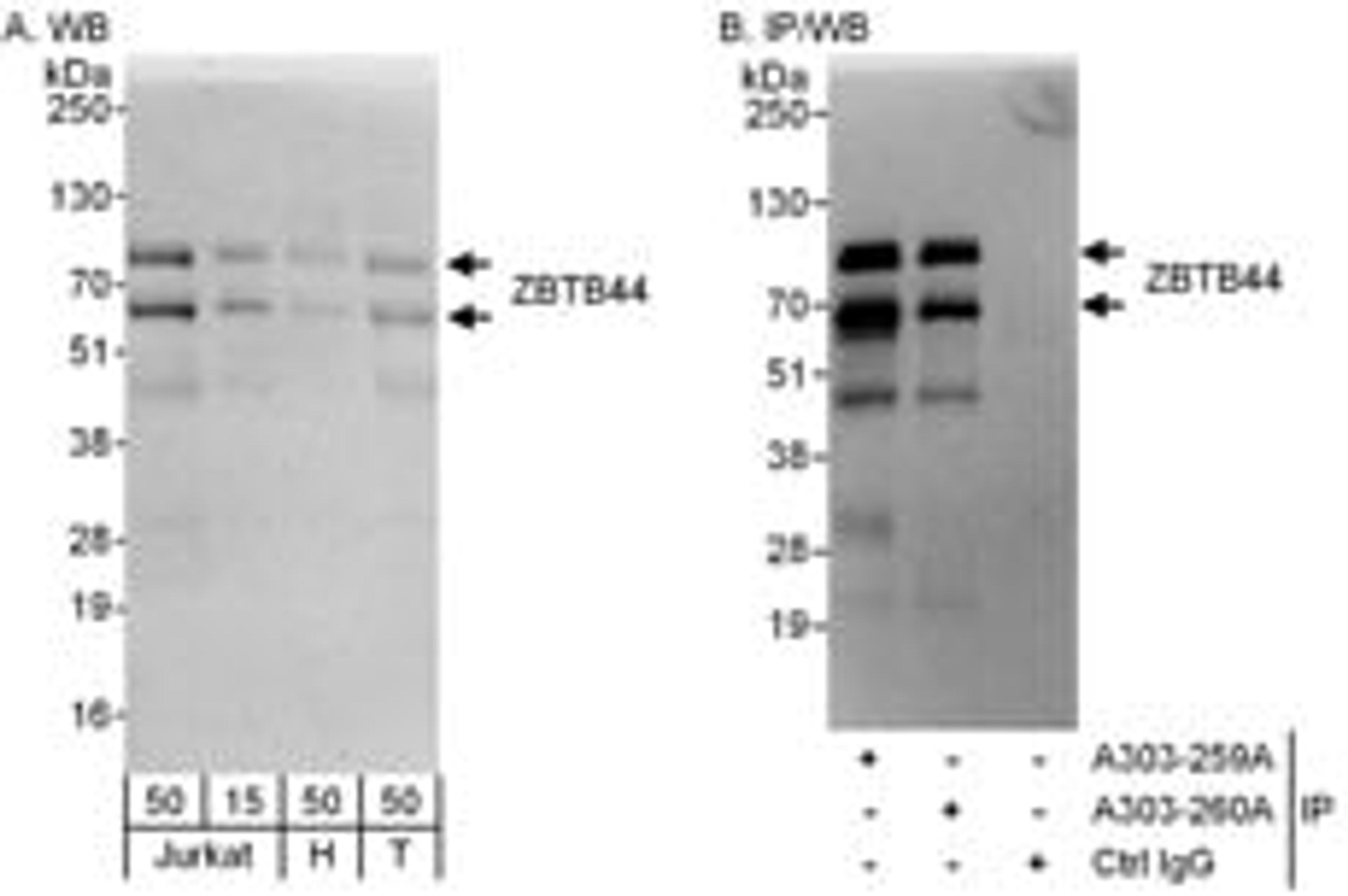 Detection of human ZBTB44 by western blot and immunoprecipitation.