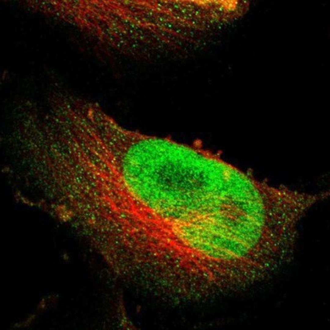 Immunocytochemistry/Immunofluorescence: NFRKB Antibody [NBP1-85096] - Staining of human cell line U-251MG shows positivity in nuclei & cytoplasm.