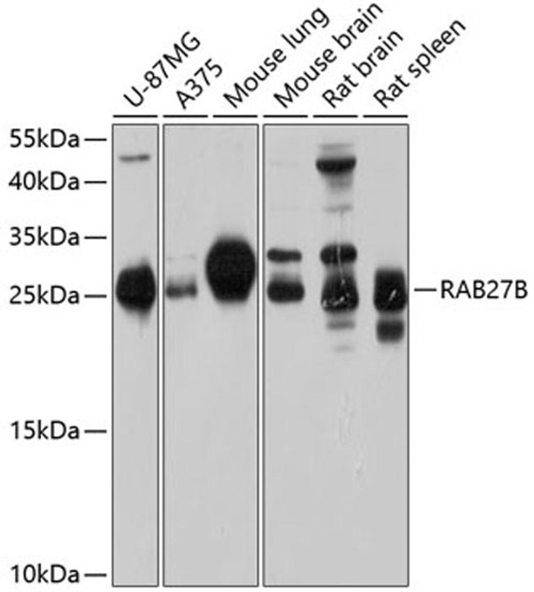 Western blot - RAB27B antibody (A10389)