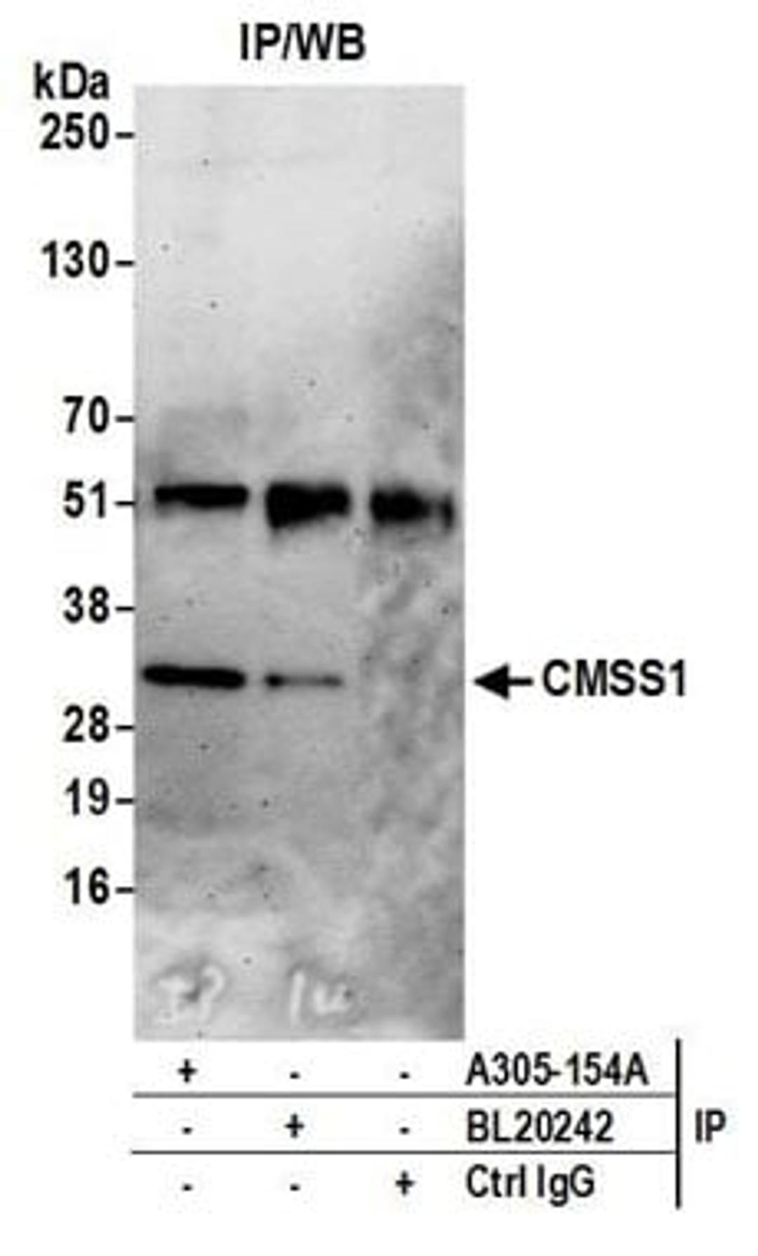 Detection of human CMSS1 by western blot of immunoprecipitates.