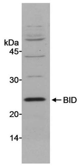 Detection of mouse BID by western blot.