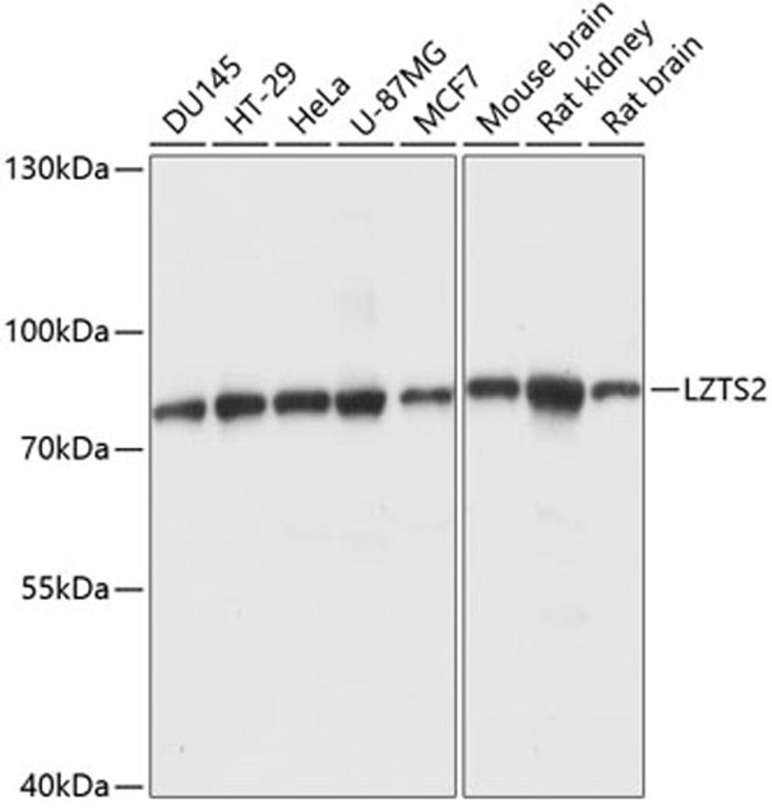 Western blot - LZTS2 antibody (A14598)