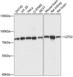 Western blot - LZTS2 antibody (A14598)