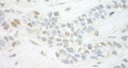 Detection of human MED13L by immunohistochemistry.