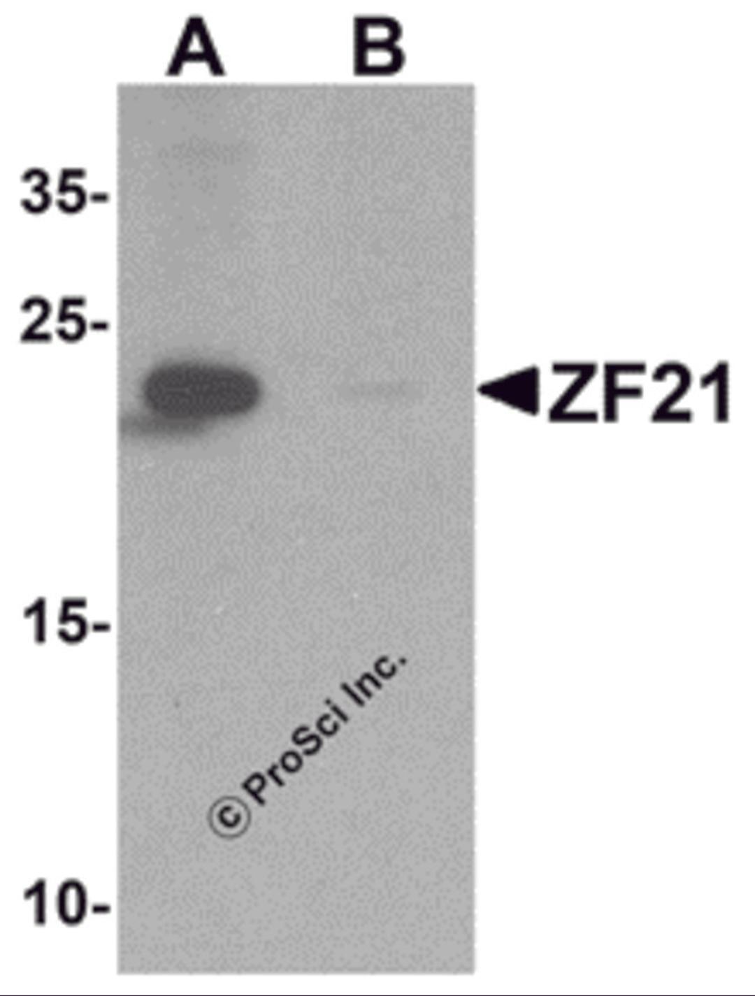 Western blot analysis of ZF21 in 3T3 cell tissue lysate with ZF21 antibody at 1 μg/ml in (A) the absence and (B) the presence of blocking peptide.