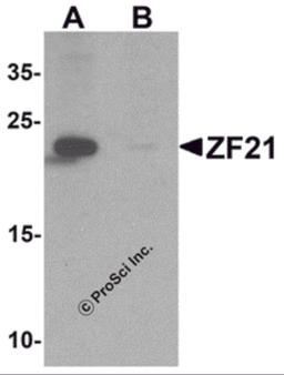 Western blot analysis of ZF21 in 3T3 cell tissue lysate with ZF21 antibody at 1 μg/ml in (A) the absence and (B) the presence of blocking peptide.