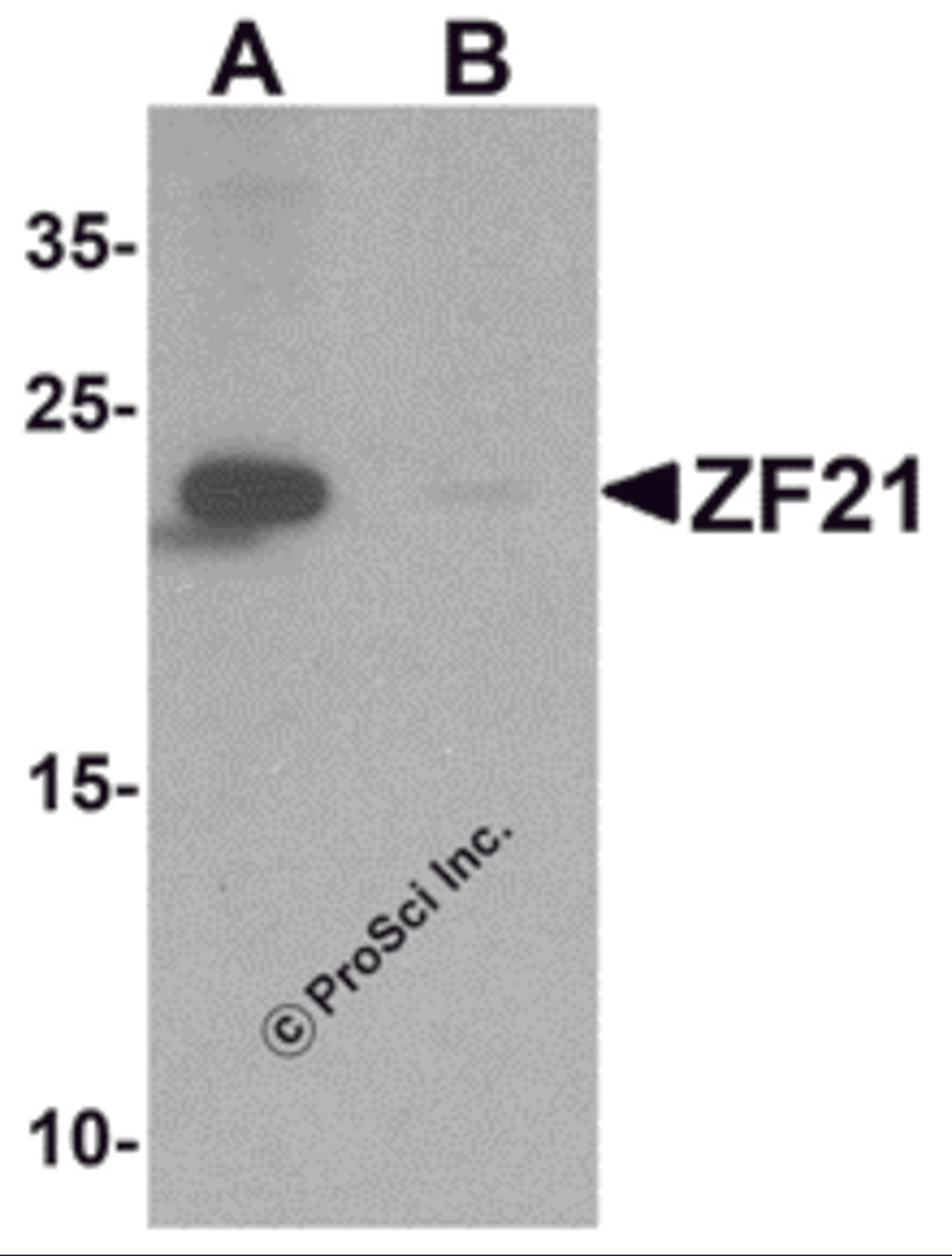 Western blot analysis of ZF21 in 3T3 cell tissue lysate with ZF21 antibody at 1 μg/ml in (A) the absence and (B) the presence of blocking peptide.
