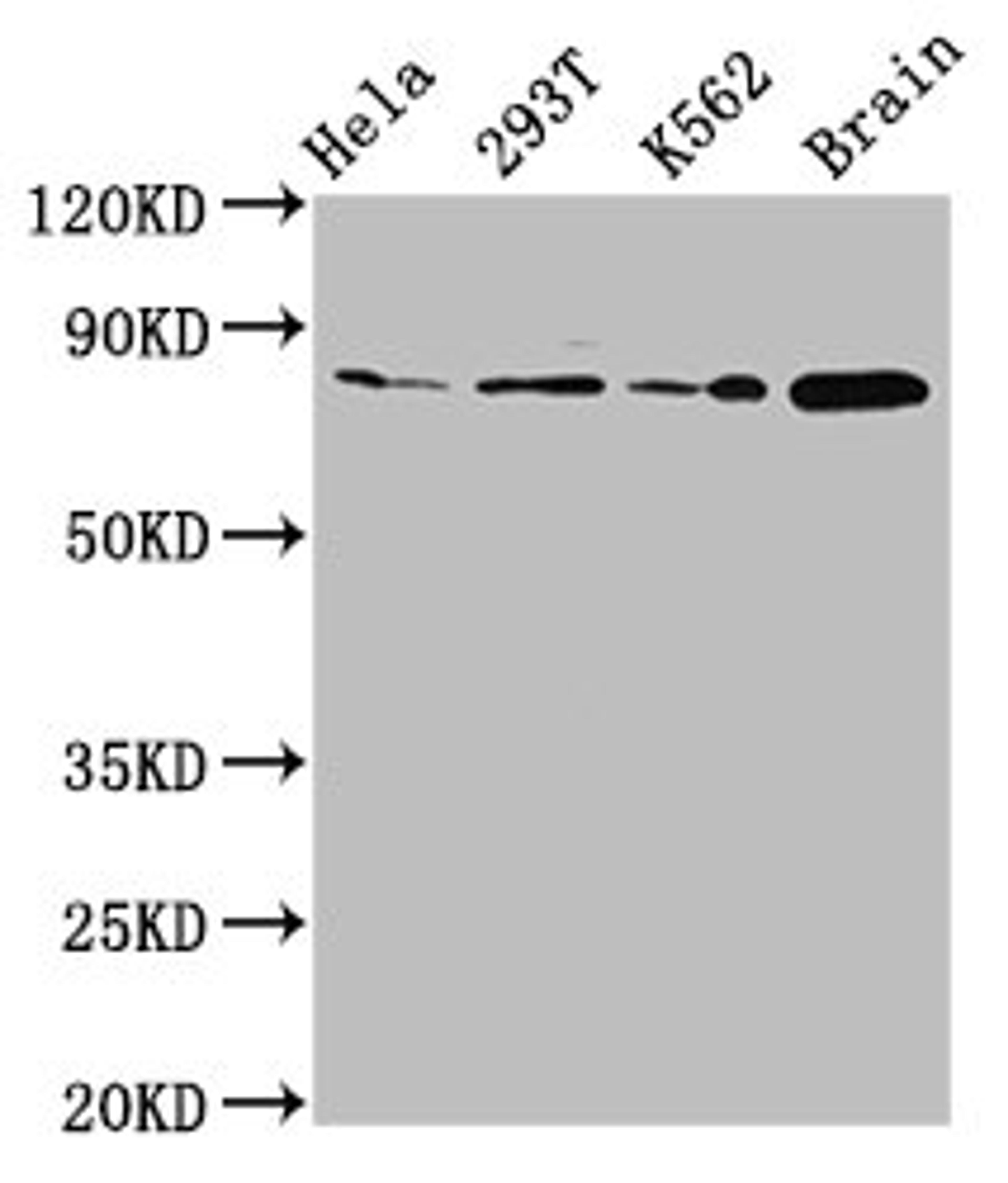 Western Blot. Positive WB detected in: Hela whole cell lysate, 293T whole cell lysate, K562 whole cell lysate, Rat brain tissue. All lanes: MKLN1 antibody at 2.7µg/ml. Secondary. Goat polyclonal to rabbit IgG at 1/50000 dilution. Predicted band size: 85, 61 kDa. Observed band size: 85 kDa