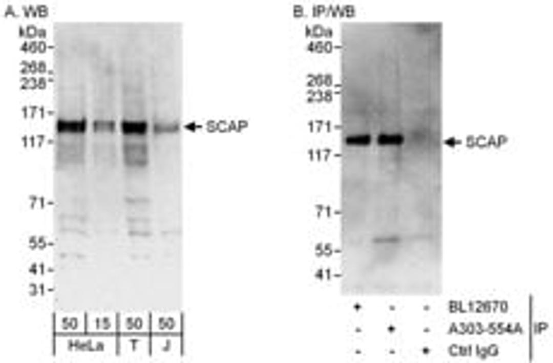 Detection of human SCAP by western blot and immunoprecipitation.