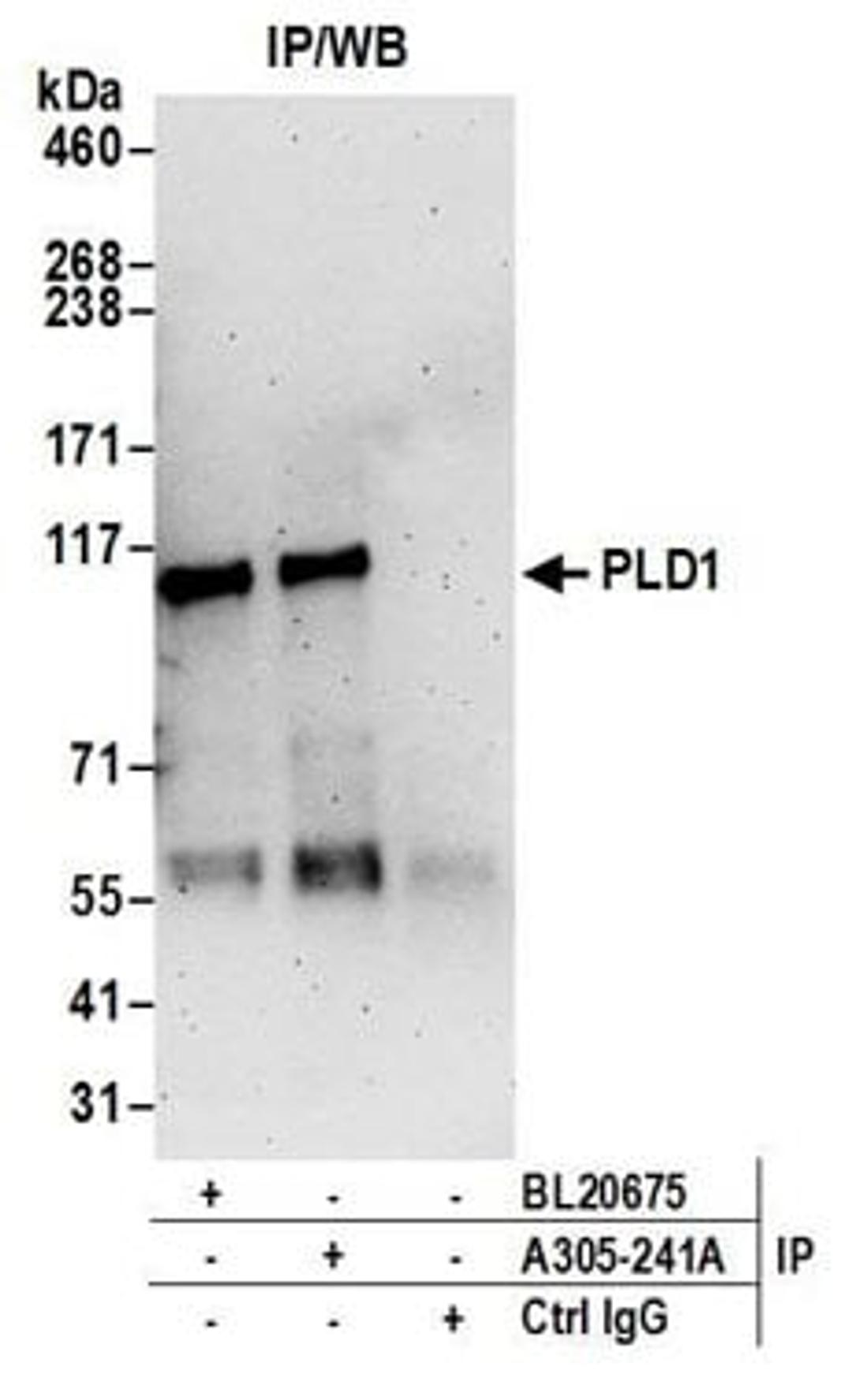 Detection of human PLD1 by western blot of immunoprecipitates.