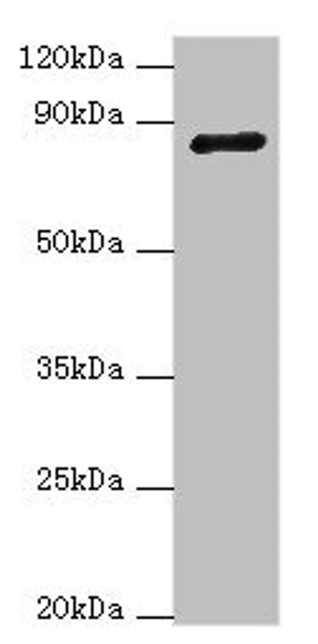 Western blot. All lanes: ADAM33 antibody at 4ug/ml + NIH/3T3 whole cell lysate. Secondary. Goat polyclonal to rabbit IgG at 1/10000 dilution. Predicted band size: 88, 85, 33 kDa. Observed band size: 88 kDa. 
