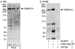 Detection of human TMEM131 by western blot and immunoprecipitation.