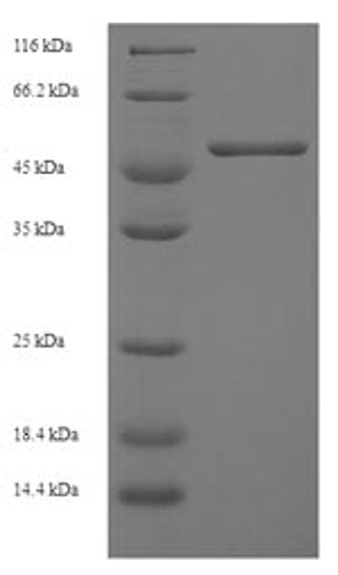 (Tris-Glycine gel) Discontinuous SDS-PAGE (reduced) with 5% enrichment gel and 15% separation gel.