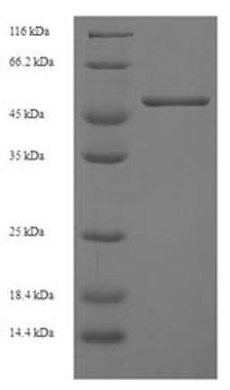(Tris-Glycine gel) Discontinuous SDS-PAGE (reduced) with 5% enrichment gel and 15% separation gel.