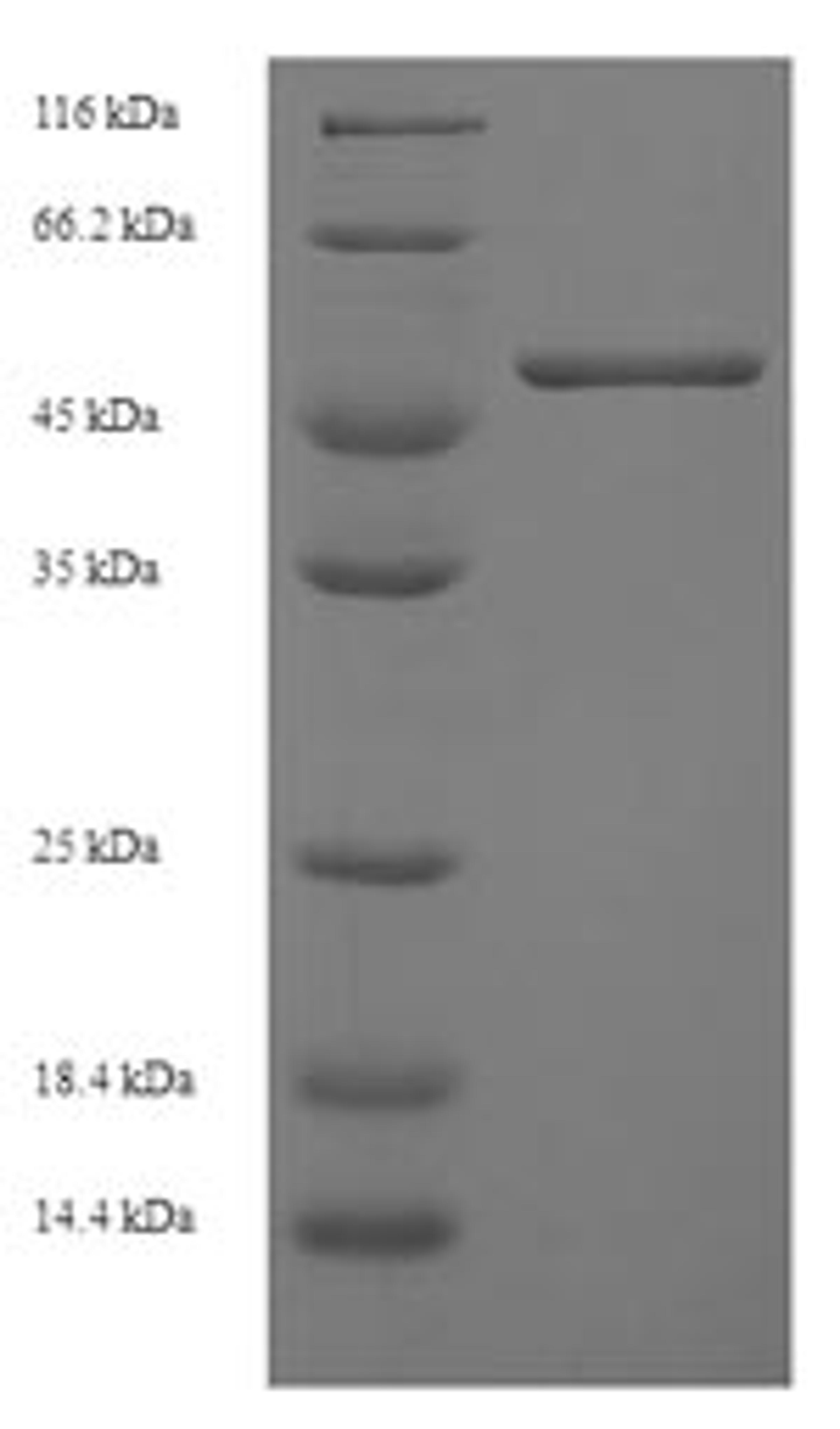 (Tris-Glycine gel) Discontinuous SDS-PAGE (reduced) with 5% enrichment gel and 15% separation gel.