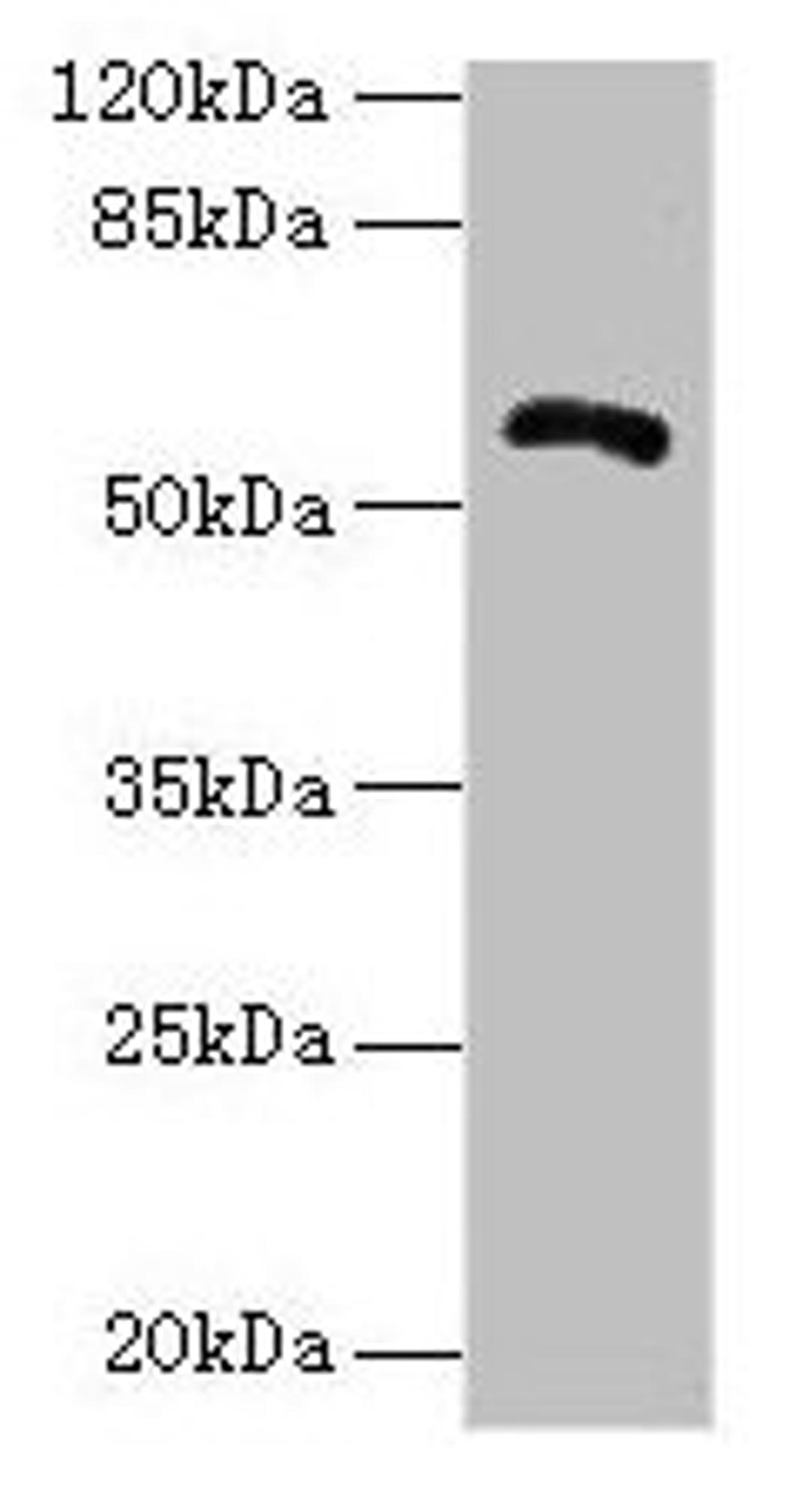 Western blot. All lanes: ZBTB18 antibody at 14µg/ml + Hela whole cell lysate. Secondary. Goat polyclonal to rabbit IgG at 1/10000 dilution. Predicted band size: 59, 60 kDa. Observed band size: 59 kDa