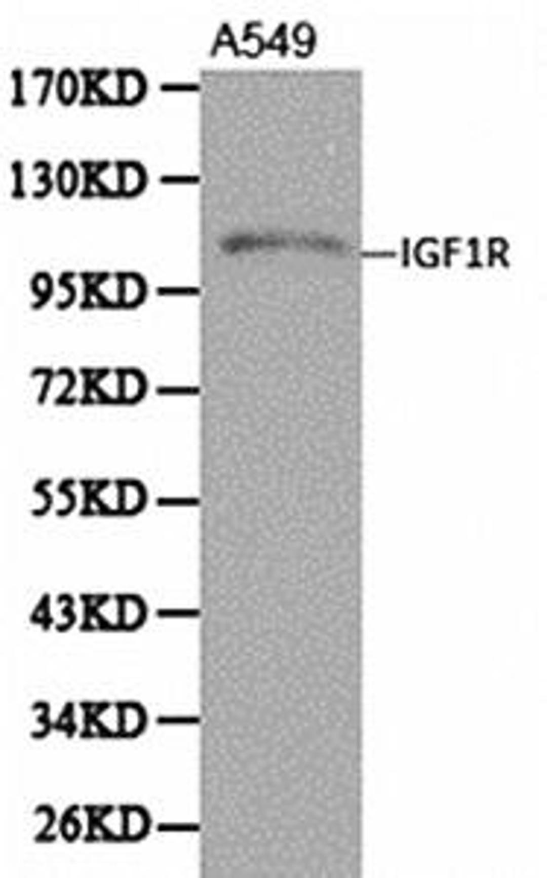 Western blot analysis of extracts of A549 cells using IGF-I Receptor beta antibody