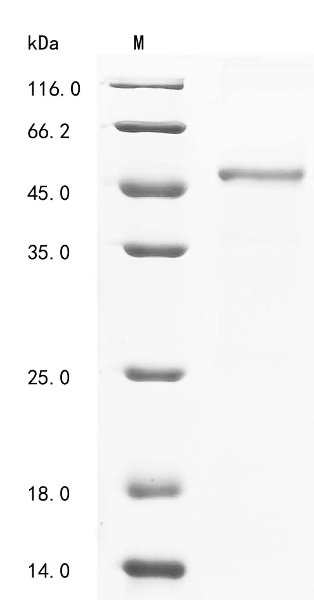 (Tris-Glycine gel) Discontinuous SDS-PAGE (reduced) with 5% enrichment gel and 15% separation gel.