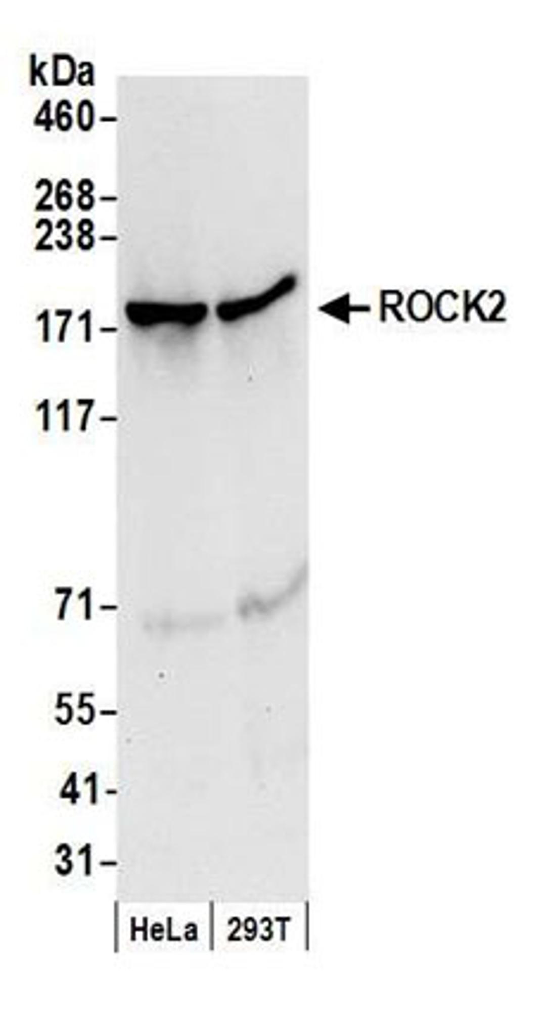 Detection of human ROCK2 by western blot.